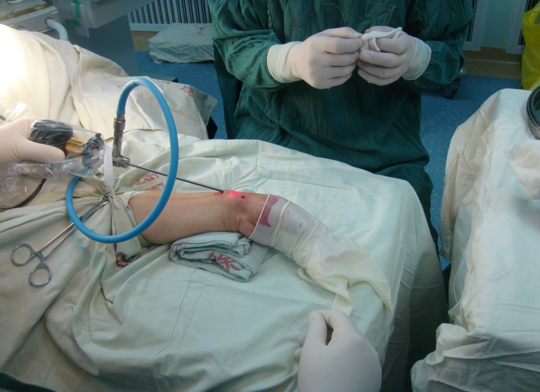 骨科成功开展徐州首例腕关节镜手术