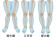 “X型腿”、“O型腿”应该怎么治疗呢？都有哪些治疗策略？
